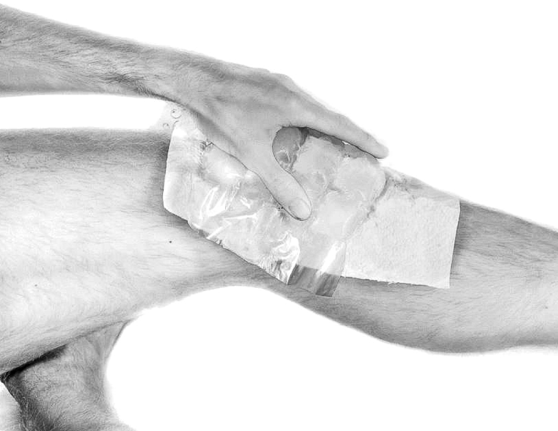 Knee_Cooling_Compression_Injury_Physiolab