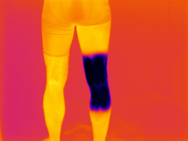 Thermal_knee_image_physiolab
